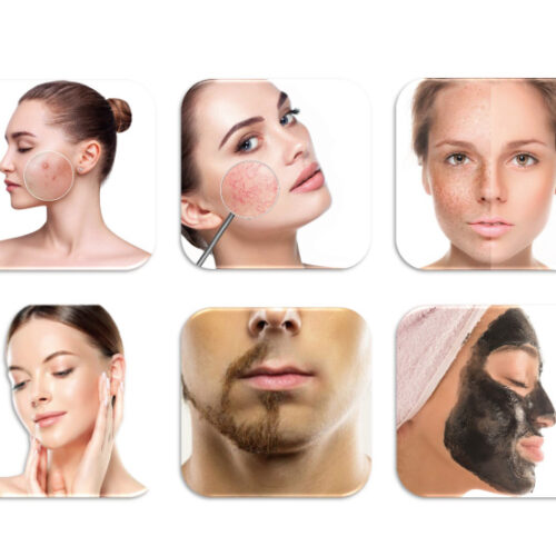 ペガサスプロのEライト機能