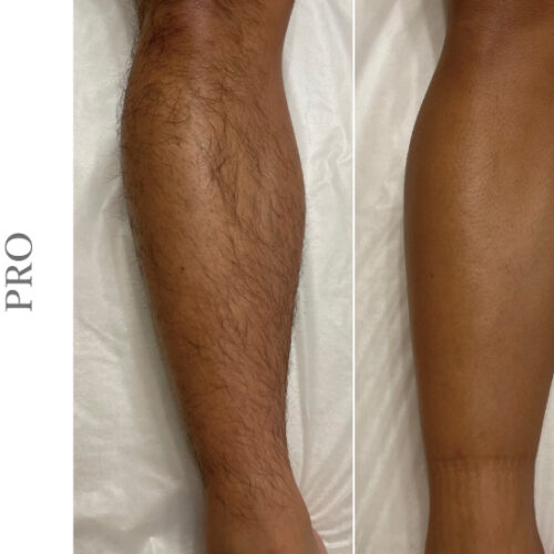 メンズ日焼けアイキャッチ