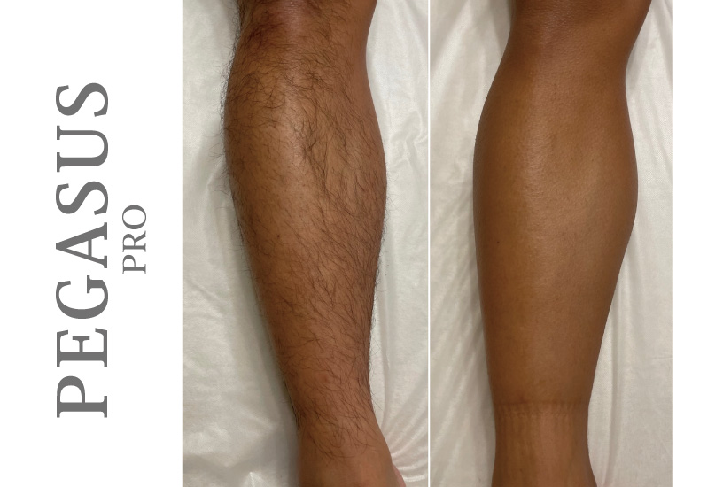 メンズ日焼けアイキャッチ