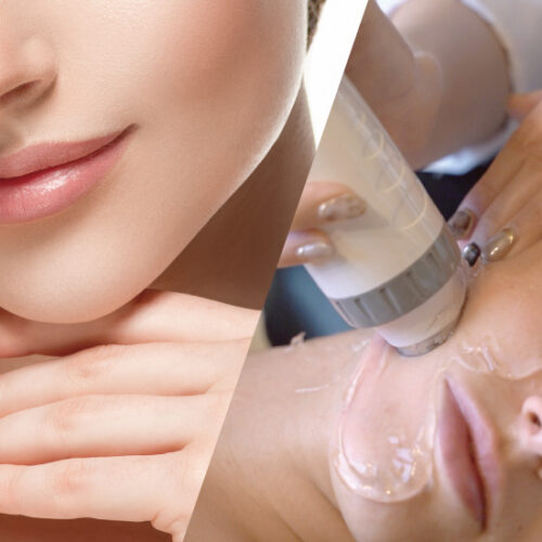 ペガサスプロ アイス高周波