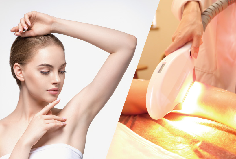 ペガサスプロ SHR高速脱毛