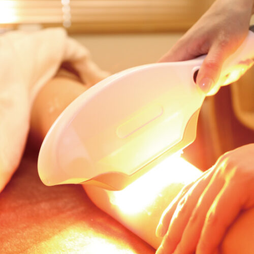 ペガサスプロ SHR脱毛