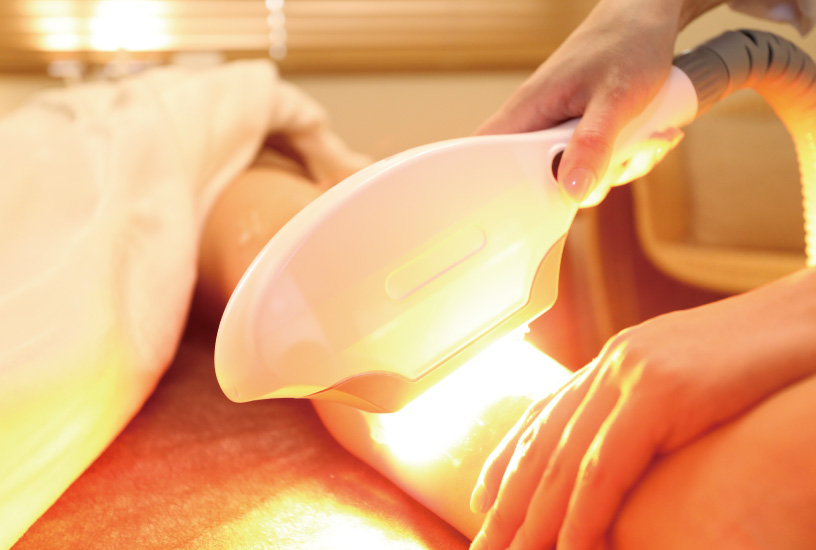 ペガサスプロ SHR脱毛