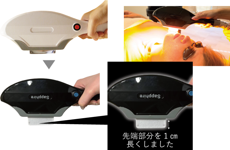 サファイヤハンドルの特徴