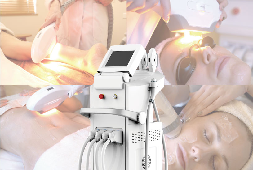 ペガサスプロおすすめ理由