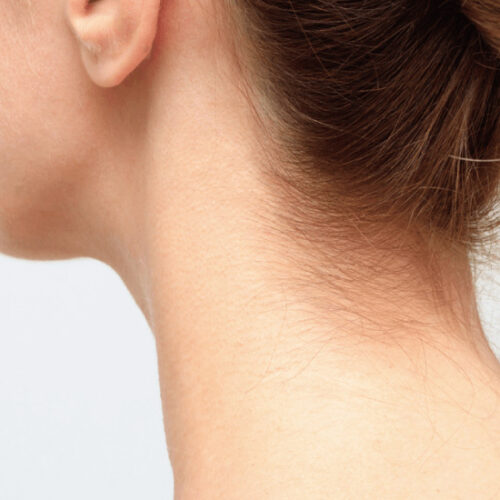 ペガサスプロでうなじ脱毛